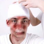 Abogados de Lesiones de Cabeza